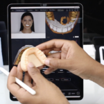Digitally planning Gingivectomy cases and creating gum contouring guides by using SmileFy